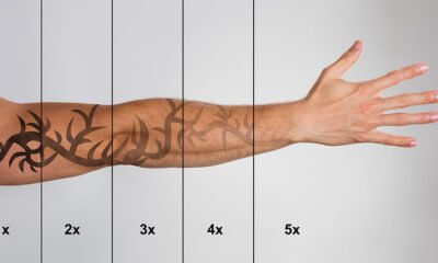 When to Skip At-Home Tattoo Removal Kits