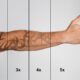 When to Skip At-Home Tattoo Removal Kits
